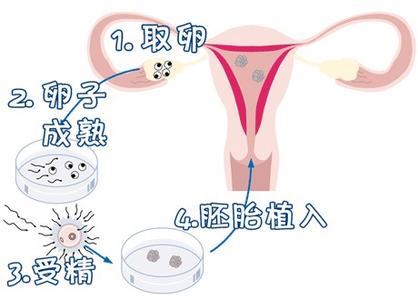 胚胎培养室